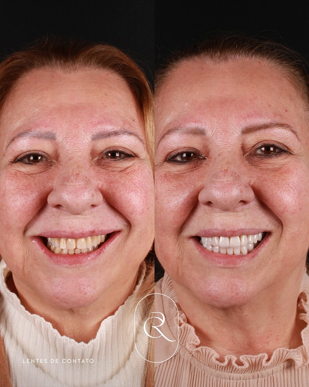 551466730_17882938164384038_769929386756027329_n