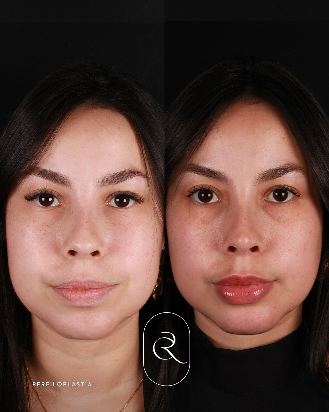 555440050_17883611925384038_3506196665255997671_n