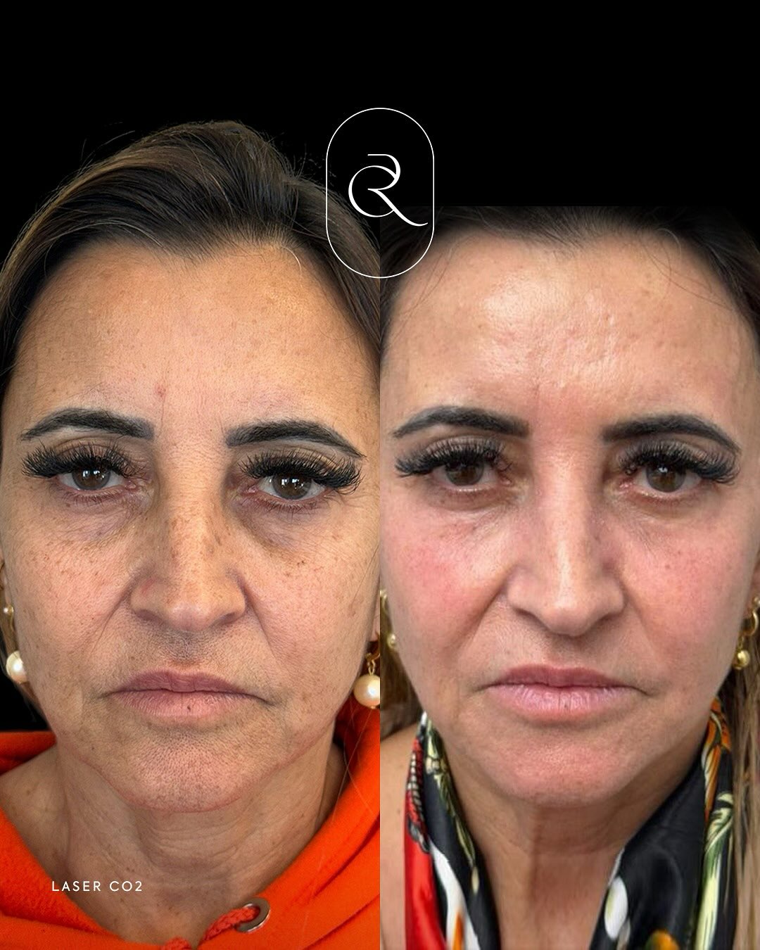 564408065_17884855254384038_7355673988504610522_n